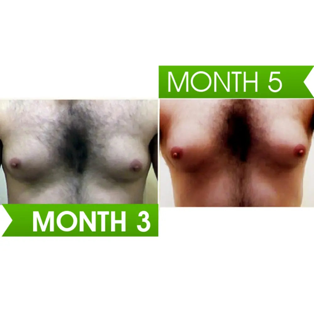 Curves - Male Breast Enlargement