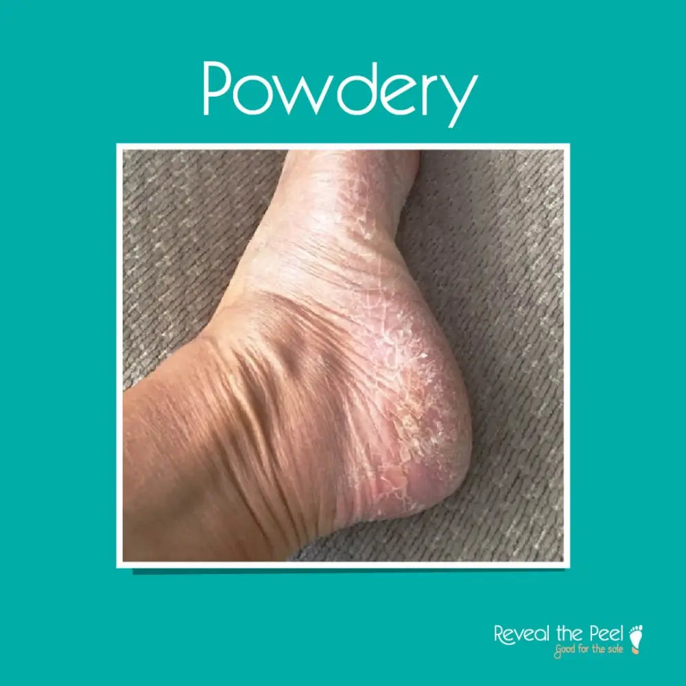Reveal the Peel - Intense Exfoliating Foot Peel Mask